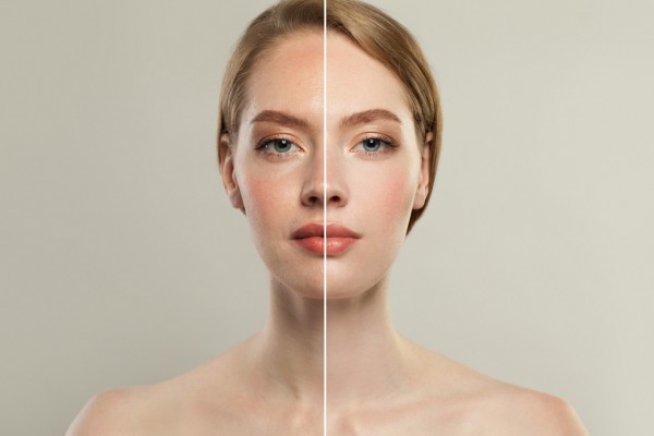 Simay Özdemir - Estetik & Güzellik, Kalıcı Makyaj, Epilasyon, Cilt Bakımı